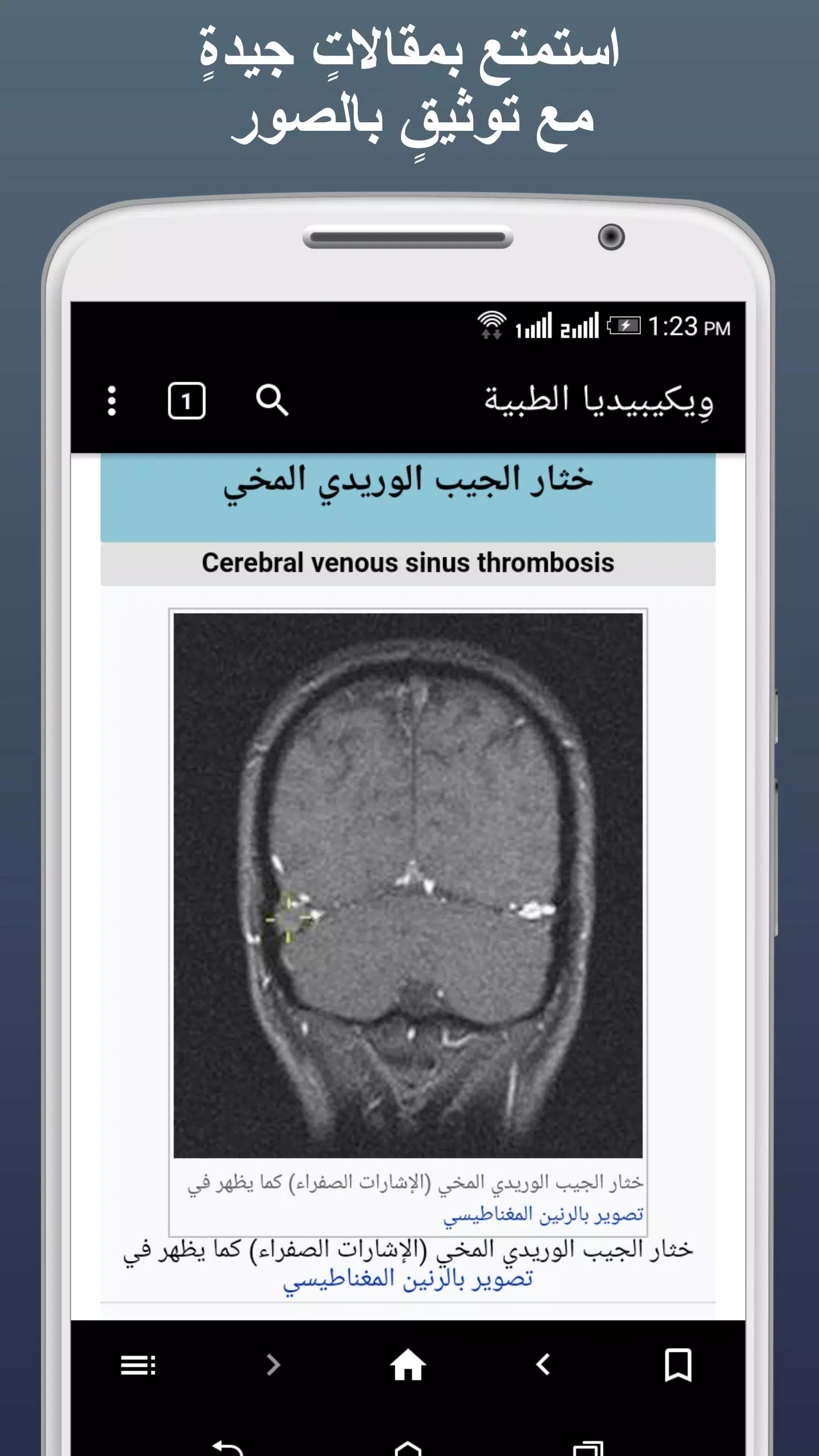ويكيبيديا الطبية 螢幕截圖 2