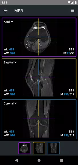 IDV - IMAIOS DICOM Viewer 螢幕截圖 3