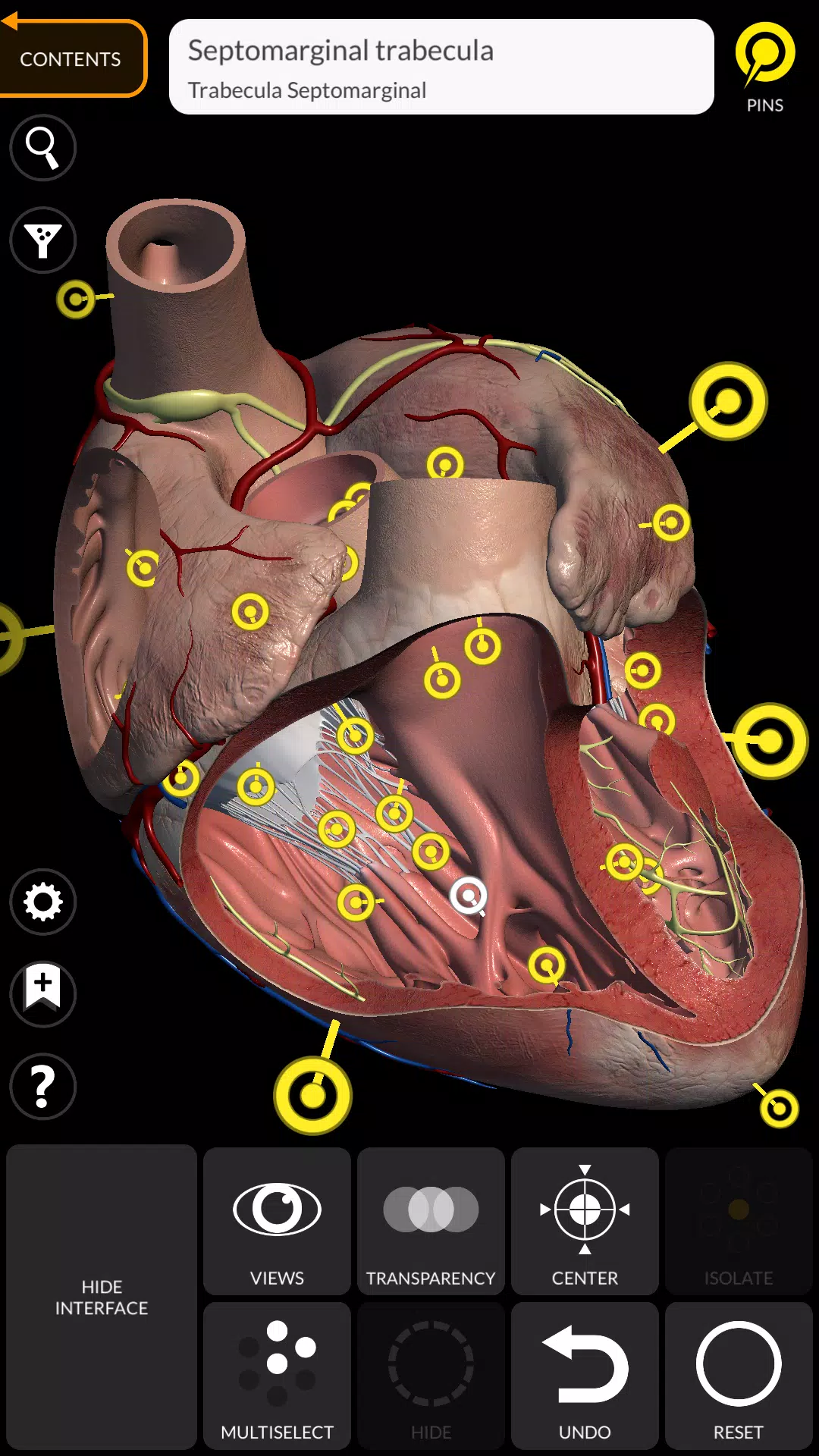 Anatomy 3D Atlas 螢幕截圖 2